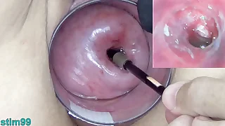 Mature Milf Cervix Play with Endoscope Japanese Cam into Uterus